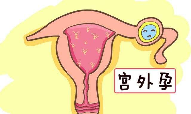 泰国选择性别可以进行试管婴儿吗试管婴儿选择性别准确率高吗