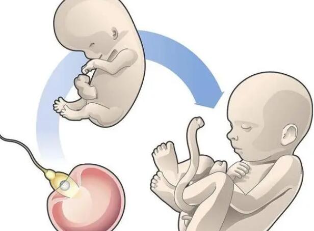 试管婴儿怎样提高卵泡质量，怎么样养出又大又圆的卵子
