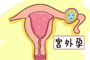 日本试管婴儿孩子，多少钱一次